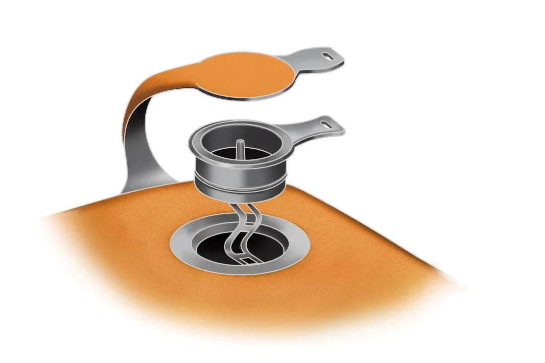 NEMO Tensor Insulated Ultralight Sleeping Pad - Regular 10 NEMO Tensor Insulated Ultralight Sleeping Pad - Regular